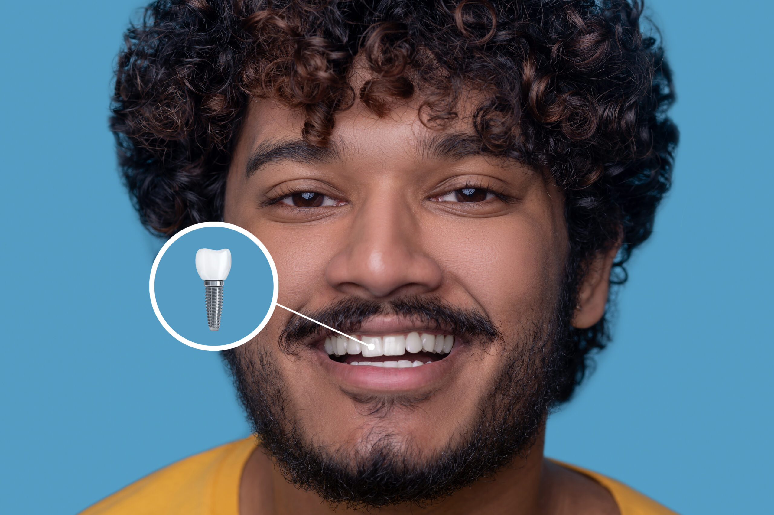 affordable dental implants