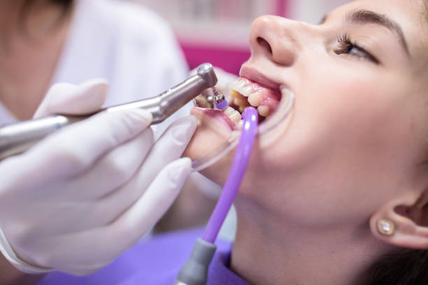 Dental Implants