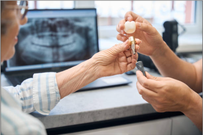 dental implants recovery tips